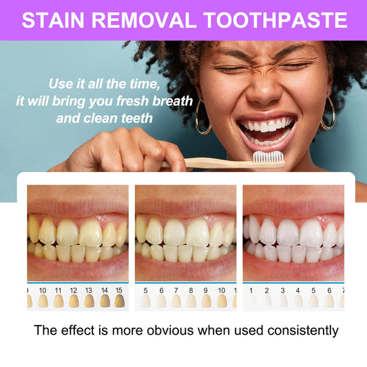 SEFUDUN– Stain Removal Whitening Toothpaste, Wholesale